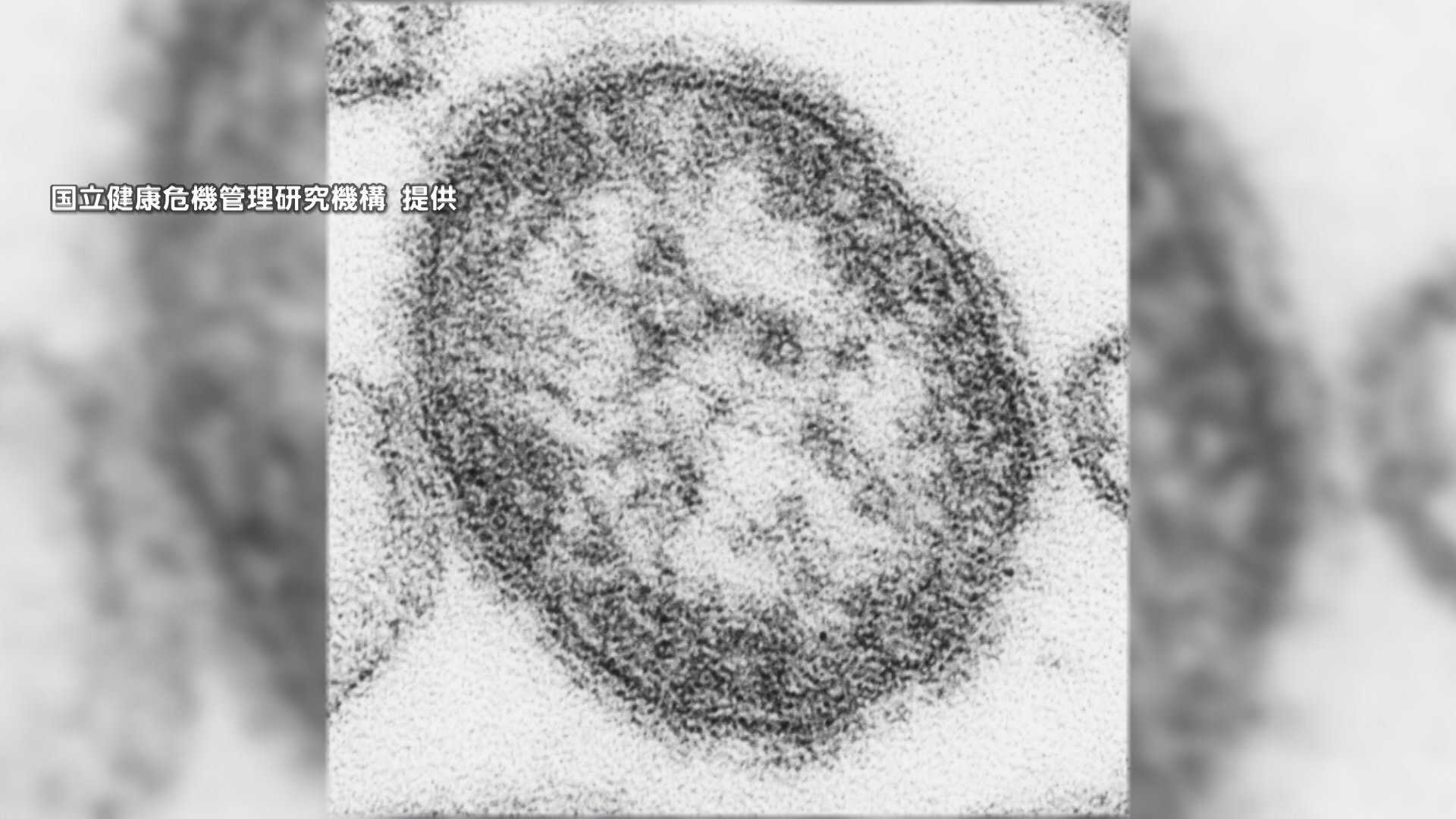 「はしか」感染者数去年の4倍超　前週から32人増え139人　海外からウイルス持ち込まれ国内で感染か（FNNプライムオンライン（フジテレビ系））